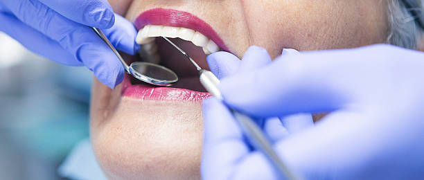 Best Emergency Wisdom Teeth Removal in Yucos, CA